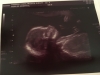 20 week scan :-)