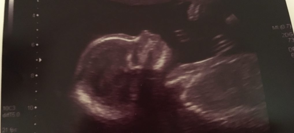 20 week scan and moving house!